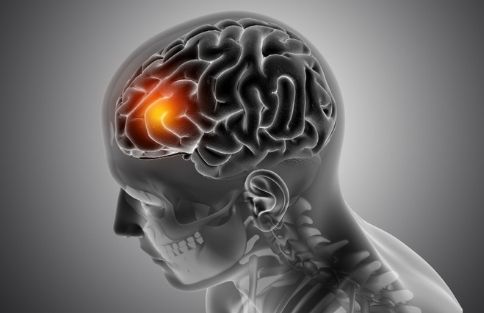 Neurologist in Udaipur - Dr Tarun Mathur