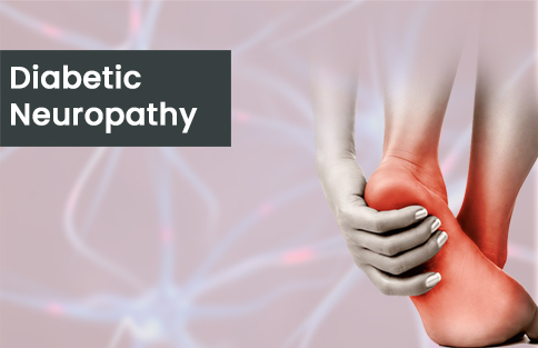 Diabetic Neuropathy