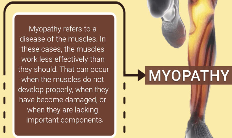 Myopathy Treatment By Specialist Myopathy Treatment By Specialist